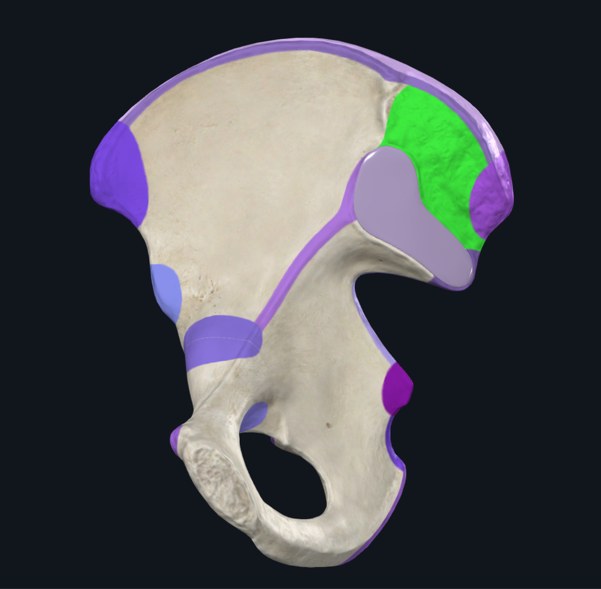 term image
