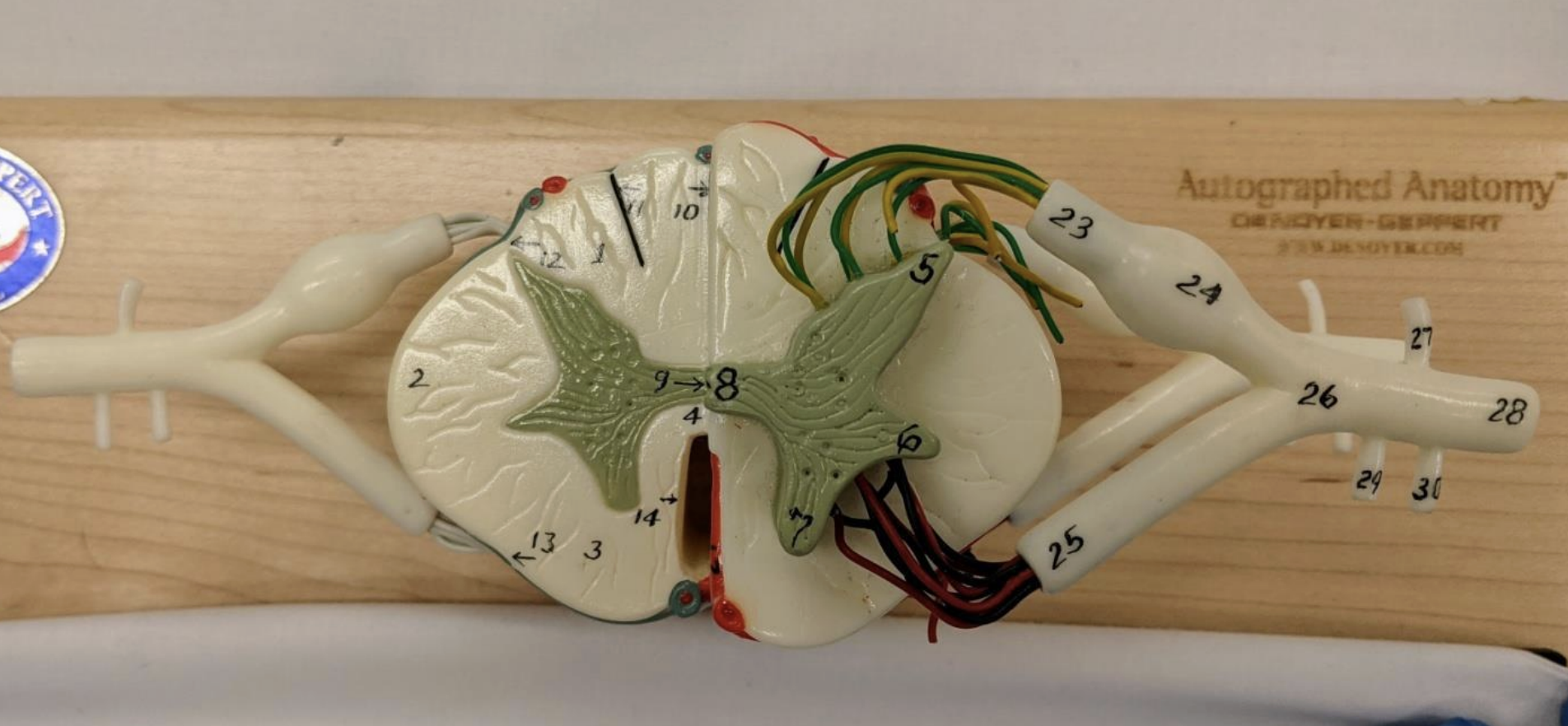 <p>Recurrent meningeal nerve</p>