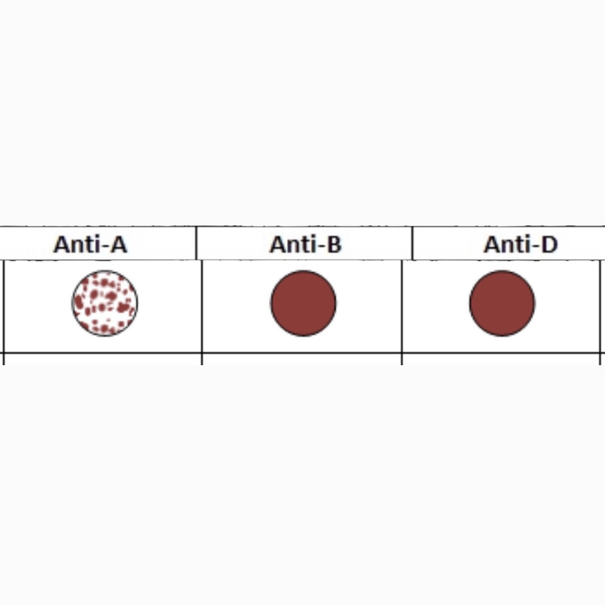 <p>What is this Blood Type? </p>