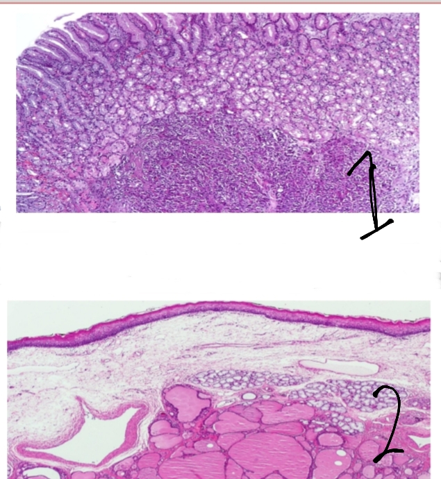<p>identify(المجمل العام لاسم الحالة) then define</p><p>1,2 refer to what ?</p>