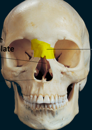 <p>Nasal bone</p>