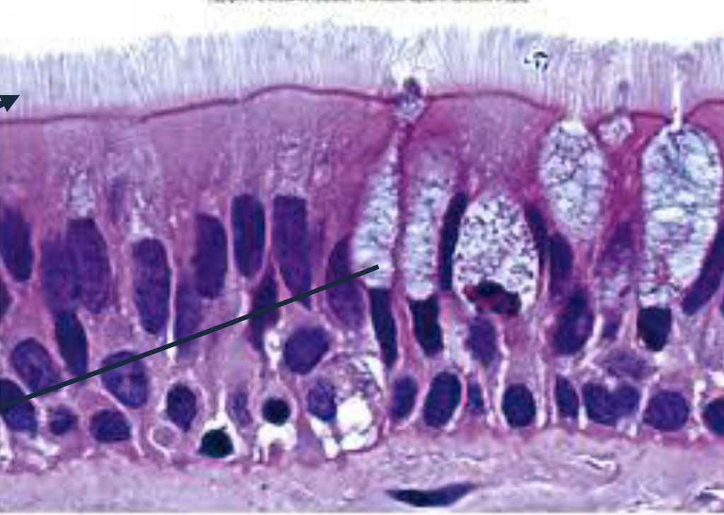 <p>What type of tissue is present in this image?</p>