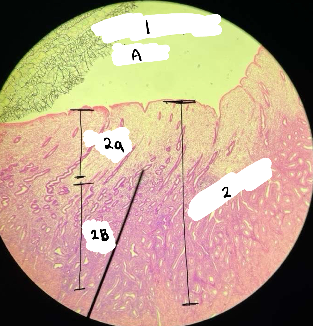 <p>2b</p>