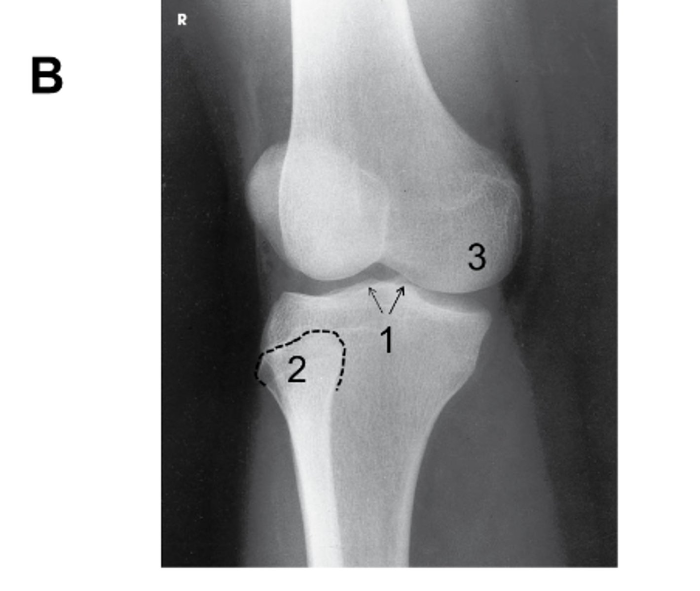 <p>Identify the projection. (Be prepared to identify anatomy and critique for positioning on the quiz)</p>