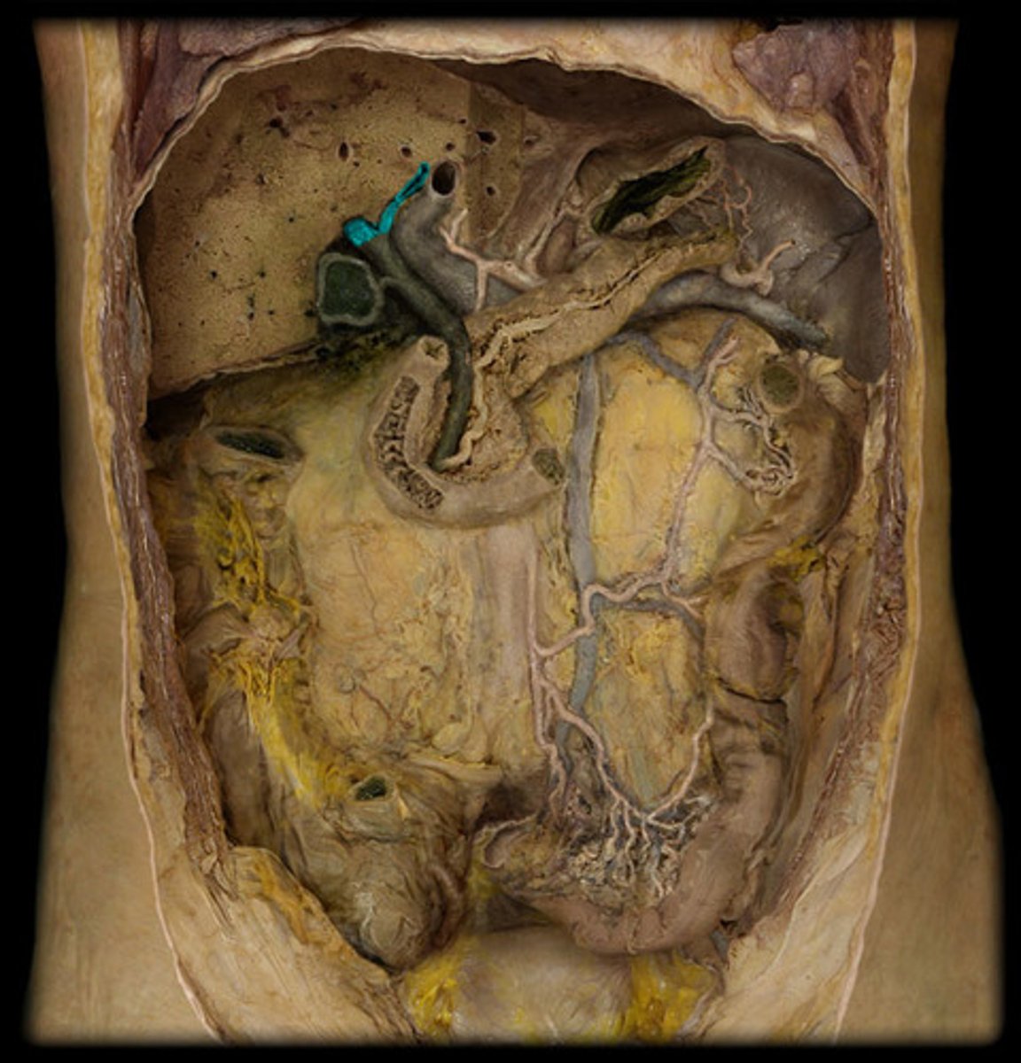 <p>Ducts that carry bile from the liver to the gallbladder.</p>