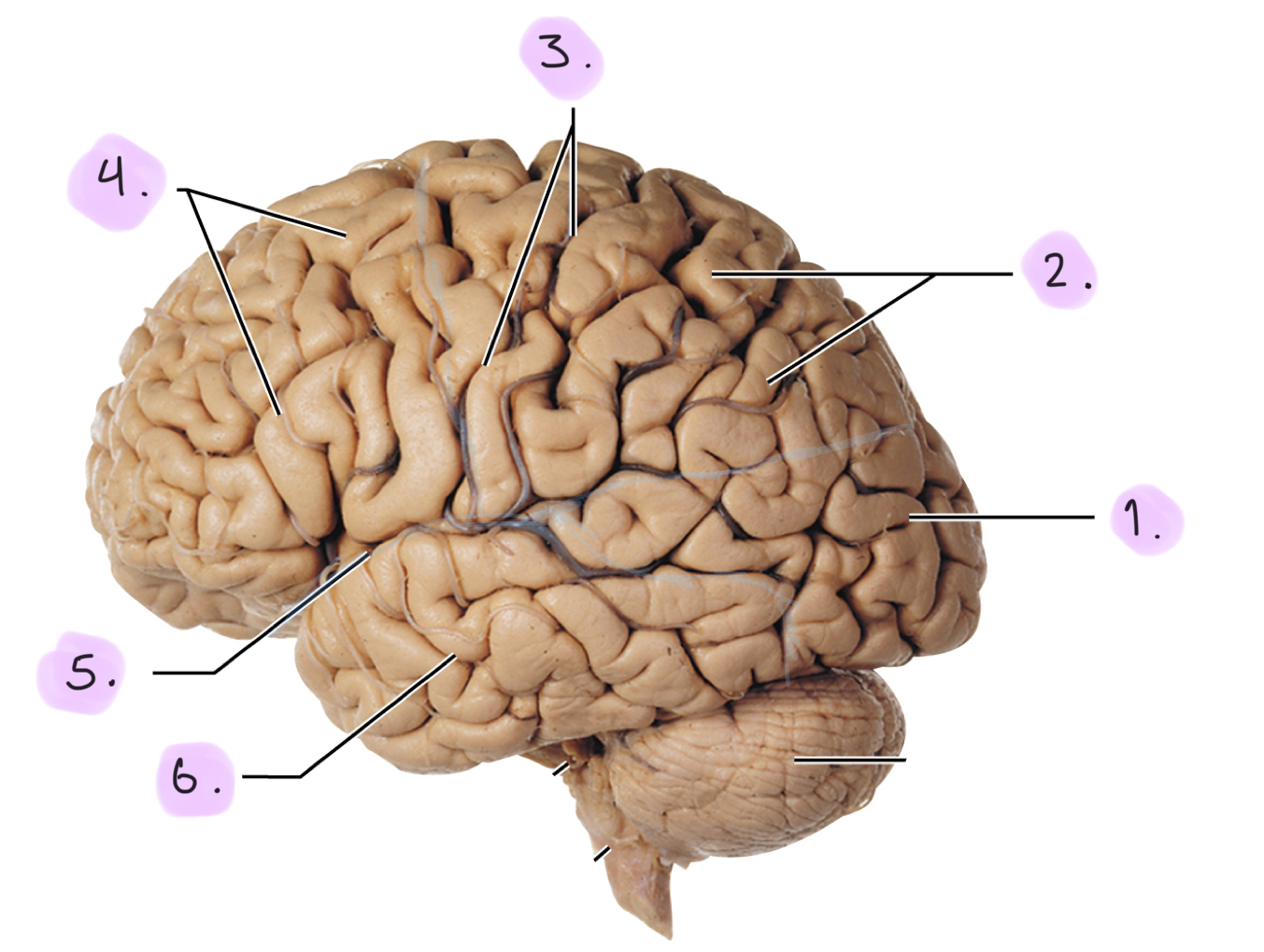 <ol><li><p>Occipital lobe</p></li><li><p>Parietal lobe</p></li><li><p>Central <strong>sulcus</strong>: Divides parietal lobe from frontal lobe</p></li><li><p>Frontal lobe</p></li><li><p>Lateral <strong>sulcus</strong>: Divides frontal lobe from temporal lobe</p></li><li><p>Temporal lobe</p></li></ol><p>Not listed: Parieto-occipital <strong>sulcus</strong>: Divides parietal lobe from occipital lobe</p>