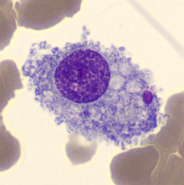 <p>Lighter blue cytoplasm with vacuoles touching the nucleus (engulfment of material)</p>