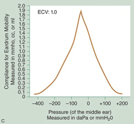 <p>what type of tympanogram is this? </p>