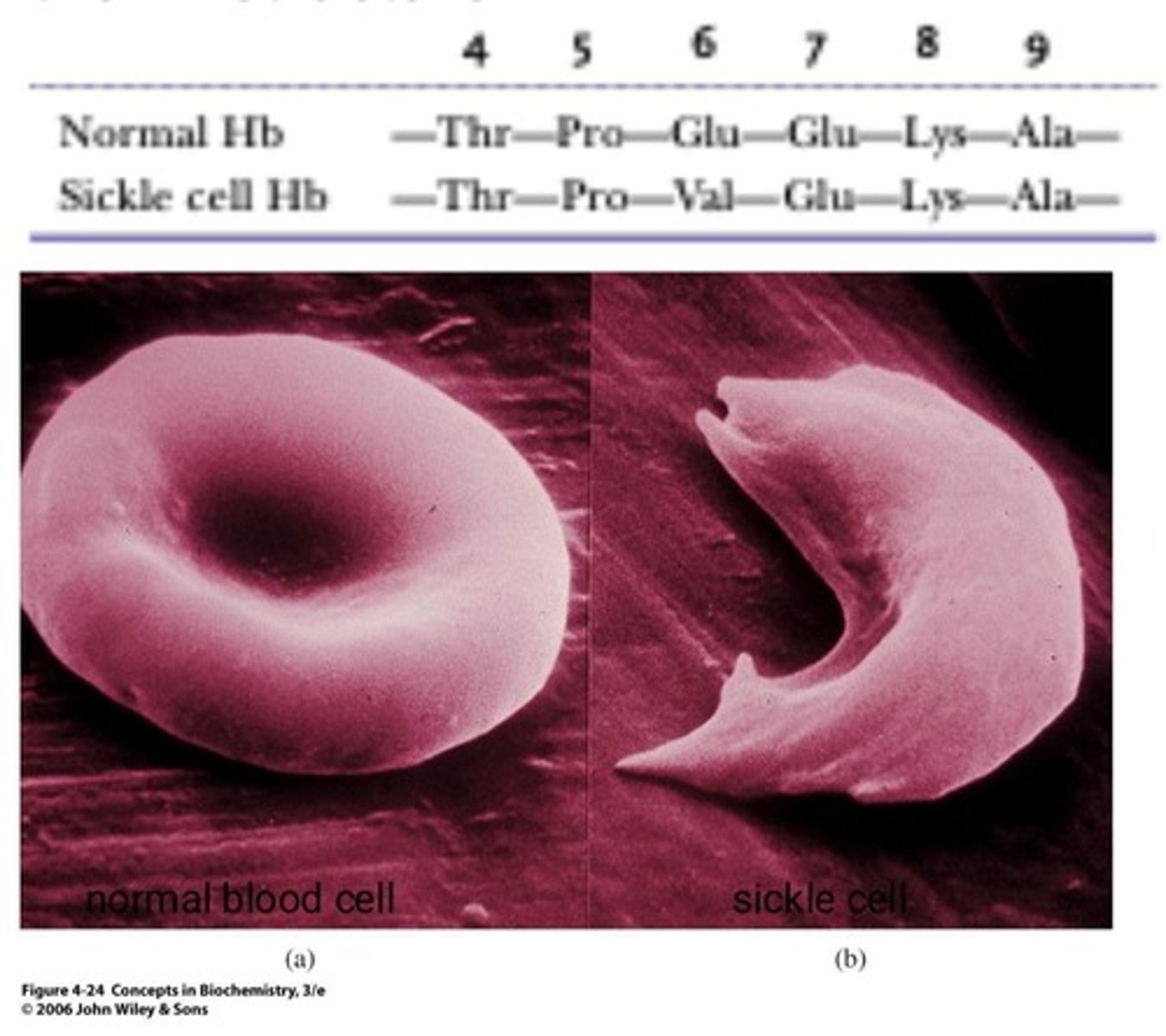 <p>Condition caused by a single amino acid change.</p>