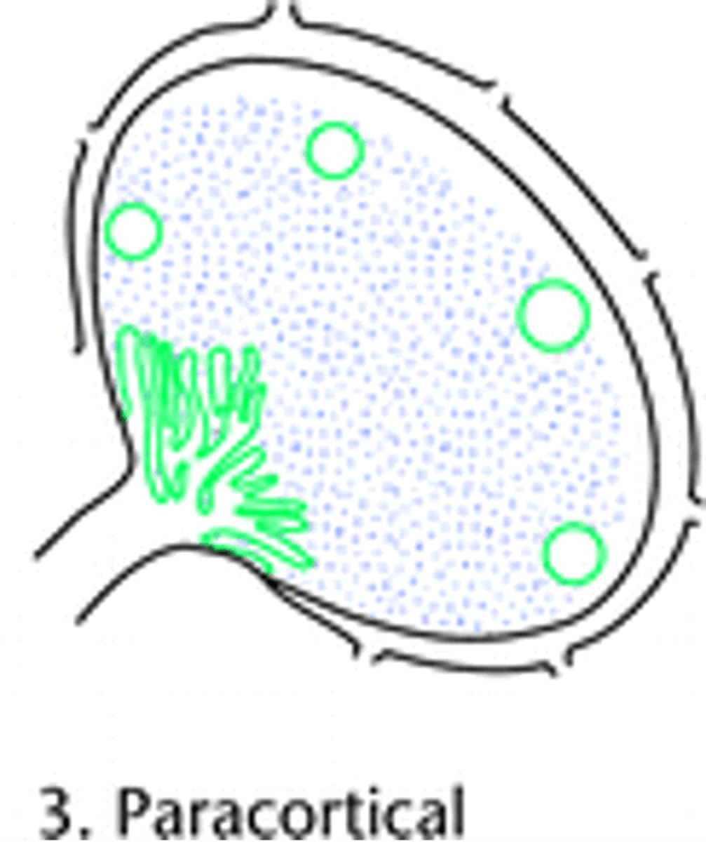 <p>What are the causes of Paracortical Chronic Lymphadentis?</p>