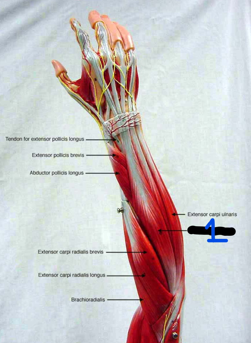 <p><span style="font-family: Arial, sans-serif">What is the origin and insertion of this muscle?</span></p>