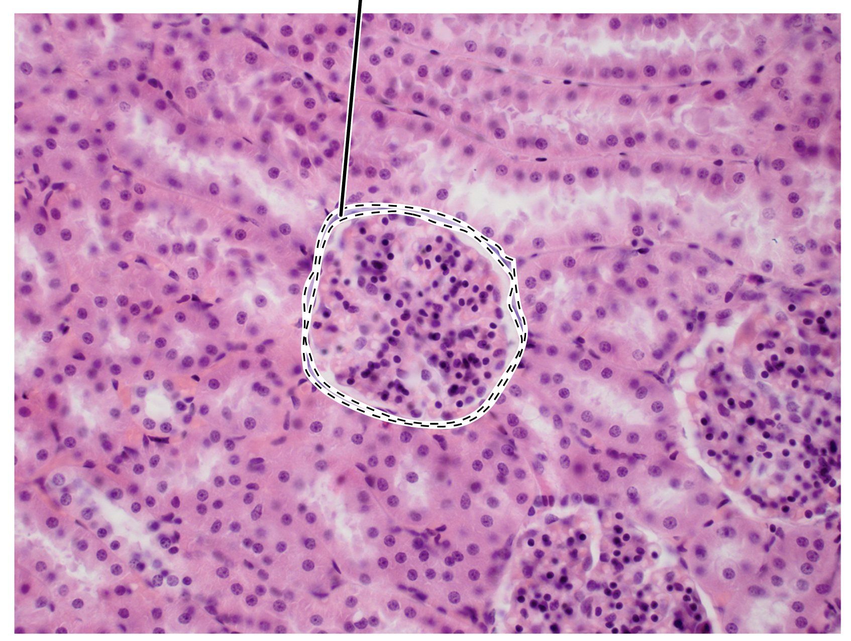 <p>Name the highlighted tissue.</p>