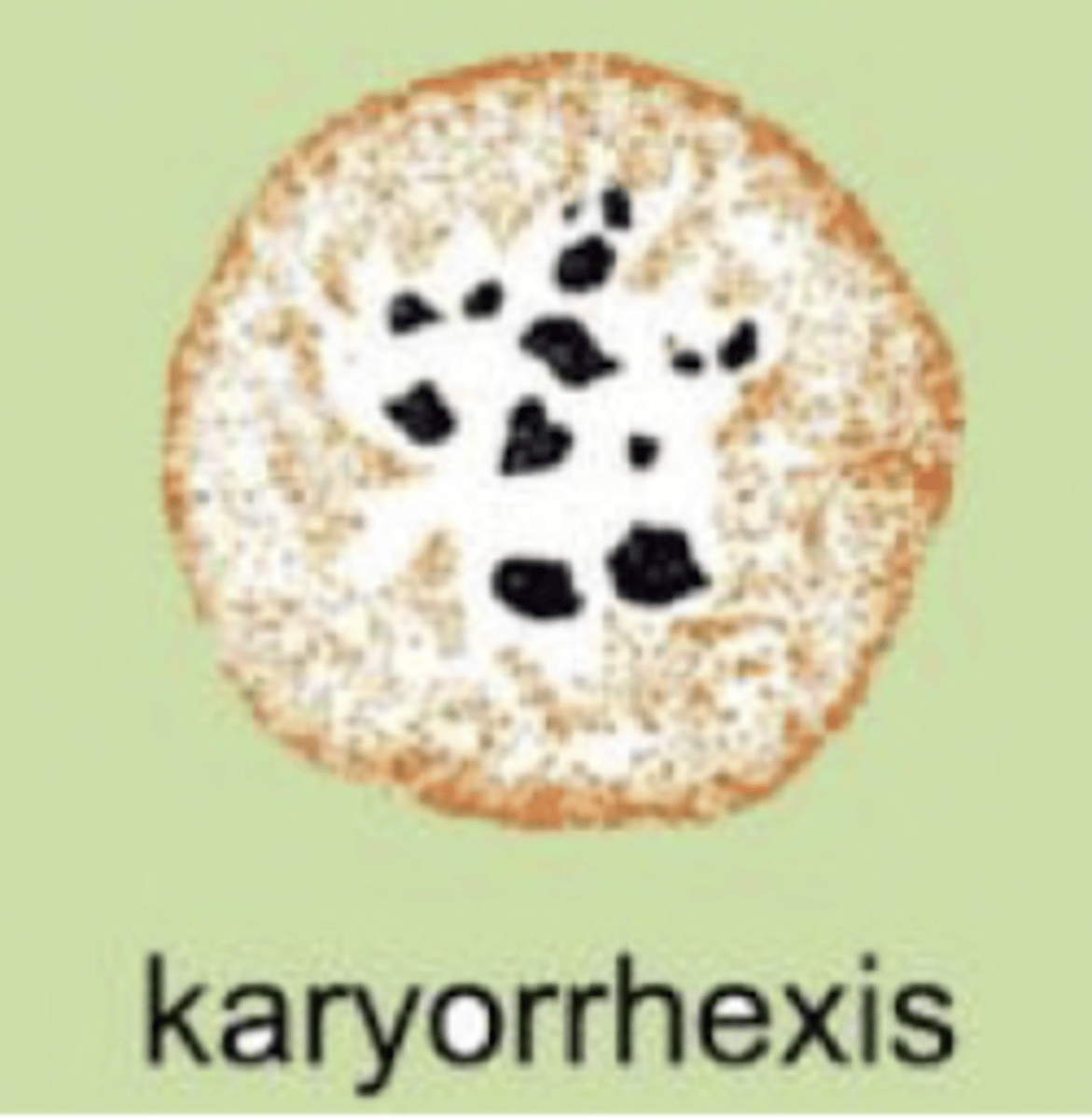 <p>the fragmentation of the chromatin after cell death. the cell has fragments irregularly floating within the cytoplasm</p>