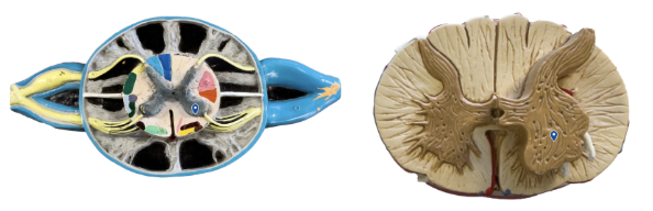 <p>What area of gray matter is the arrow pointing to?</p>