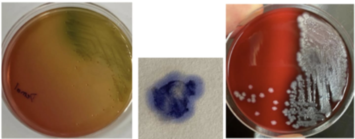 <p>A vet submitted swabs from sheep with exudative dermatitis (AKA "green wool disease", "fleece rot") for</p><p>culture and identification. A bluish-green discoloration of the wool next to the areas of inflammation was</p><p>noted. The organism isolated is gram-negative and oxidase-positive. It has several characteristic morphological features on culture, including a distinctive odour. Note the typical colony features on BA and MAC</p>
