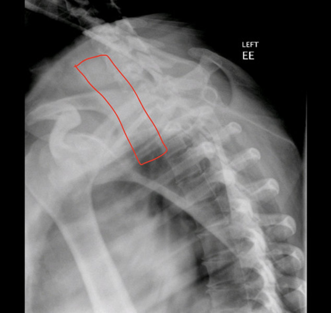 <p>what is this image?</p>