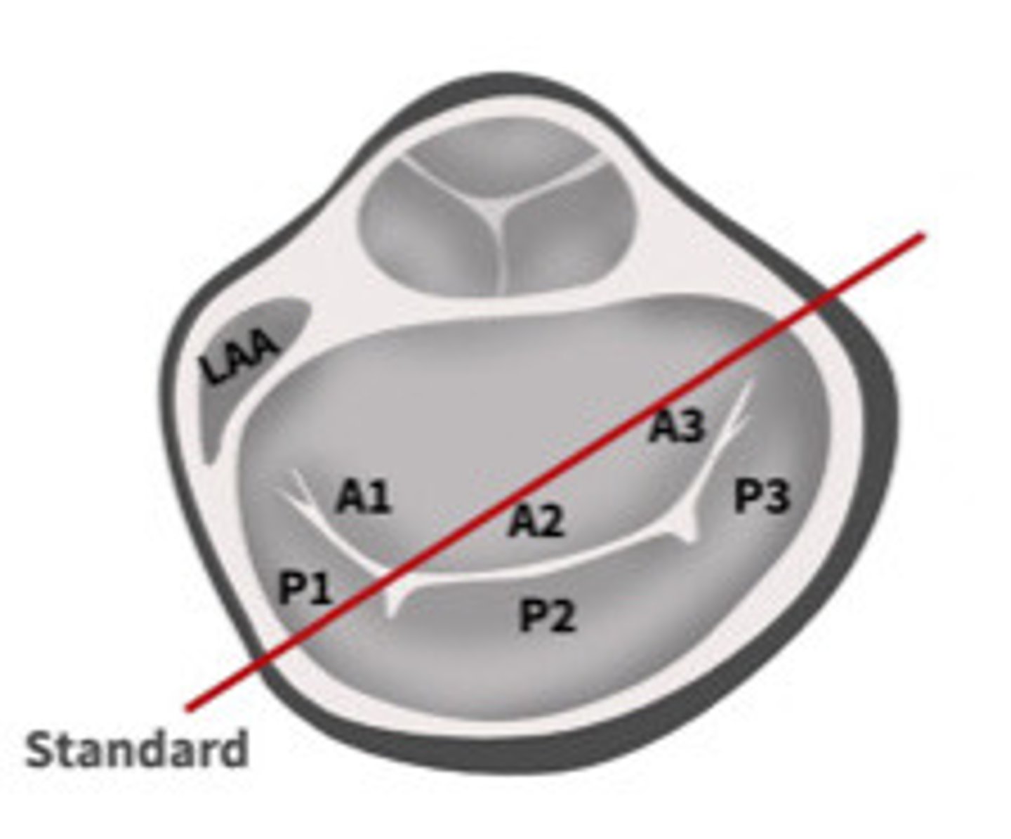 <p>What view is represented by the line</p>