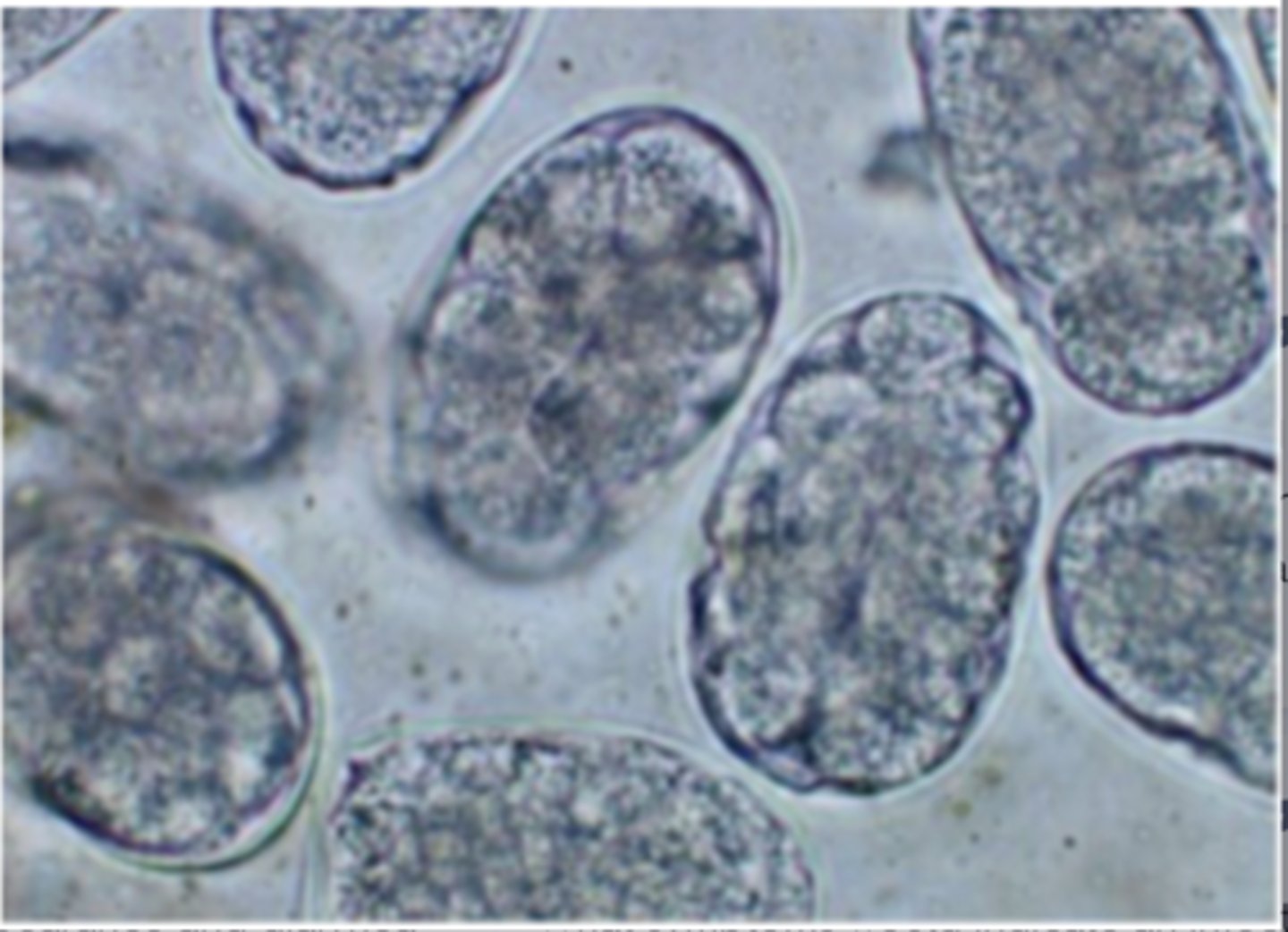 <p>A 6-year-old rottweiler presents with the eggs depicted in the picture. How was the parasite transmitted?</p>