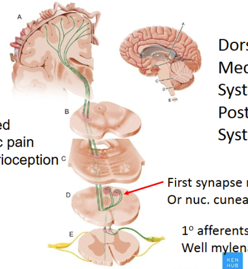 <ol><li><p>First-order neurons are well-myelinated and large. They have AP in the axon which is transmitted to the cell body. These neurons go through the dorsal horn, and turn 90 degrees to ascend straight up. They synapse for the first time at the <span>nucleus gracilis or nucleus cuneatus. These are in the </span>myelencephalon.</p></li><li><p>The second-order then cross over and decussate in the medulla (this is also where the nucleus gracilis/cuneatus are) and ascend to the <span>ventral posterolateral (VPL) of the thalamus. They synapse here.</span></p></li><li><p>The third-order neurons project to the somatosensory cortex/post-central gyrus and synapse here.</p></li></ol><p></p>