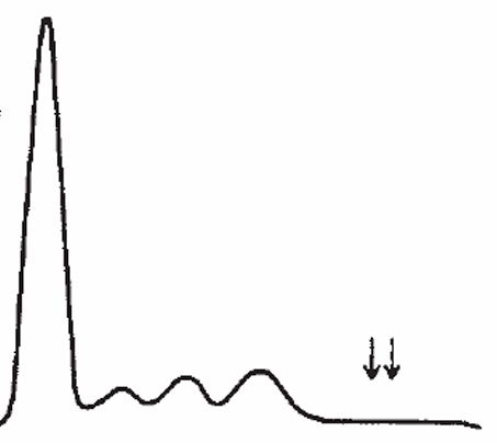 <p>Hypogammaglobulinemia</p>