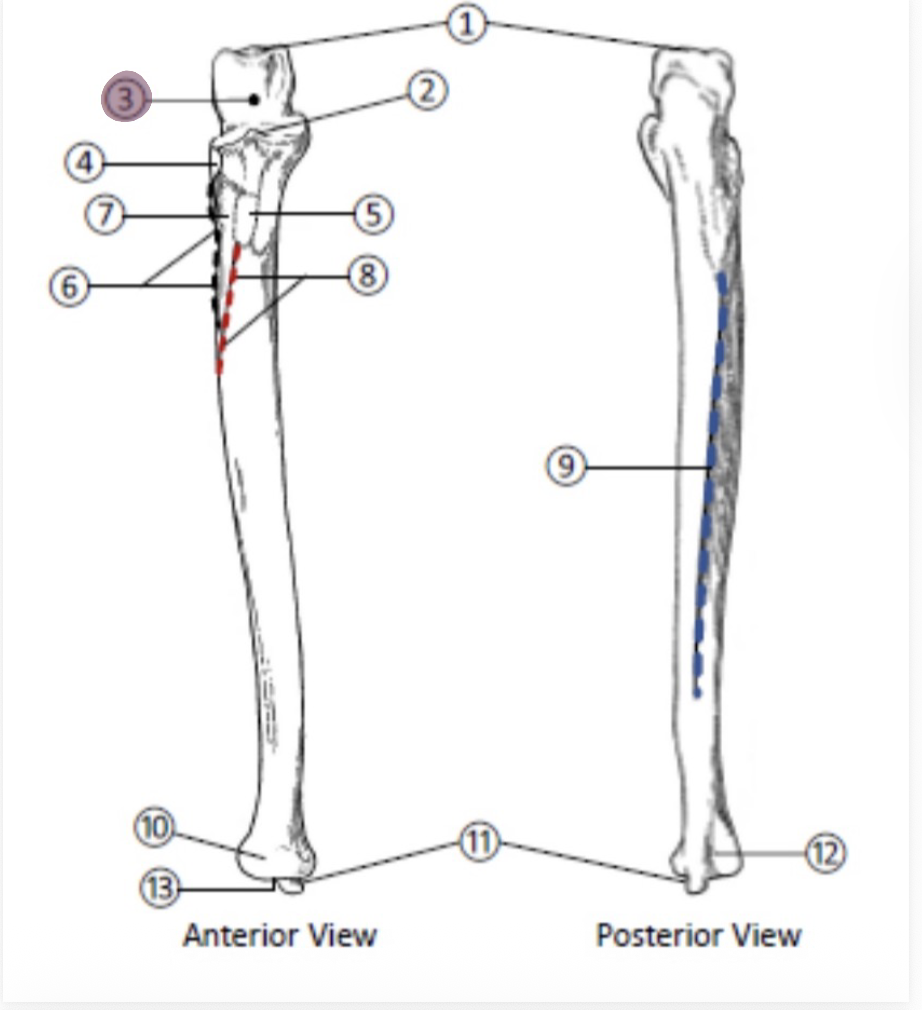 <p>On the Proximal end of the Ulna, which part is highlighted (3)?</p>