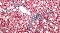 <p>identify</p>
