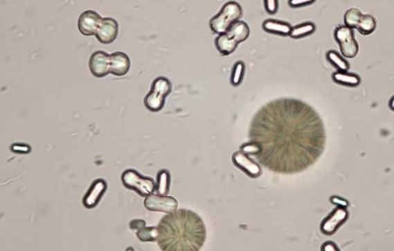 <p><span>These structures were found in the urine of a horse observed on 40X. What are the structures?</span></p>