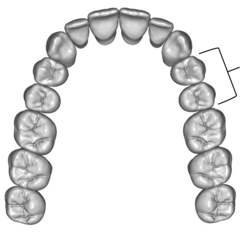 <p>What type of teeth are the lines pointing to </p>