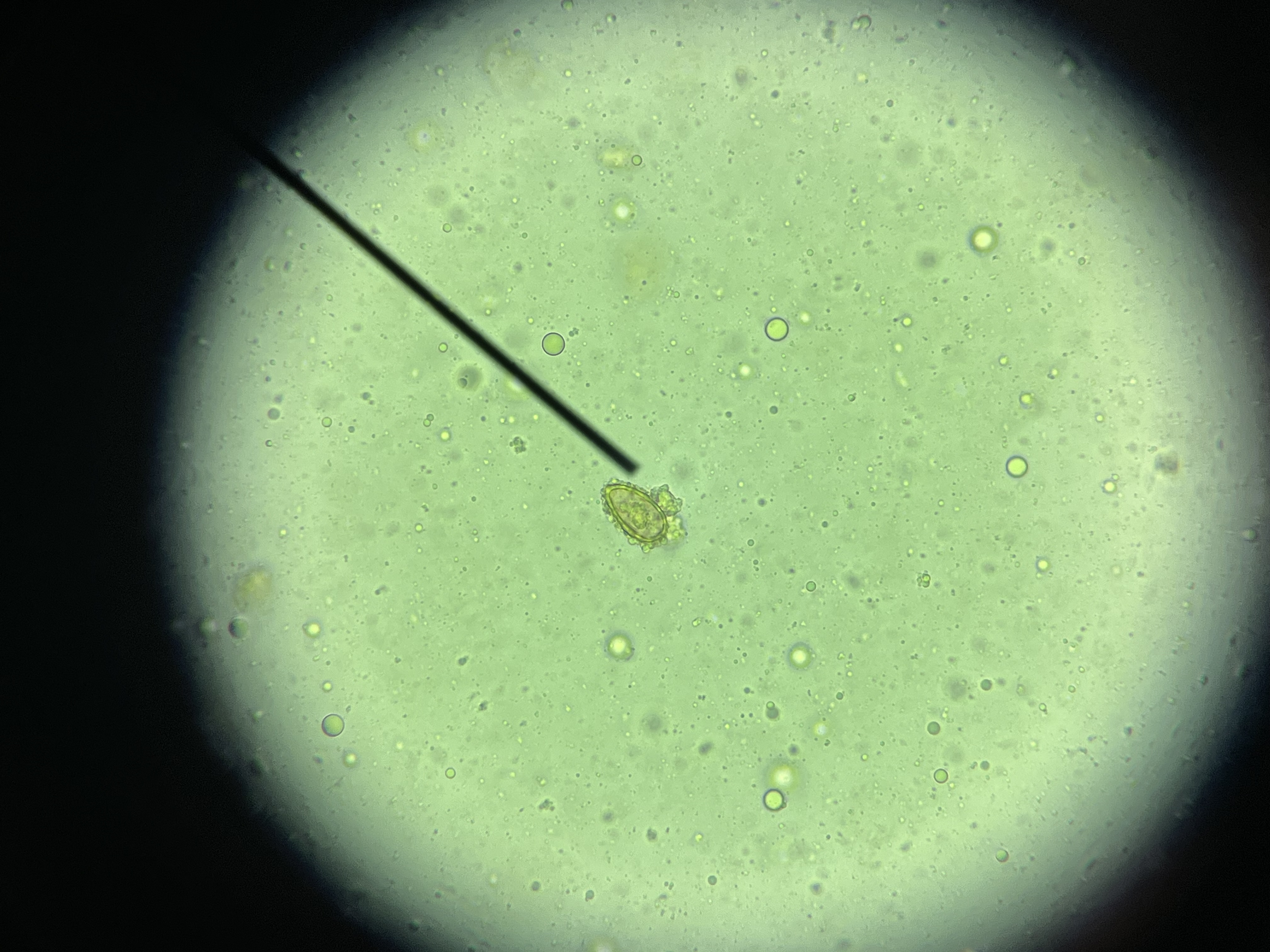 <p>thickened rim around operculum called shoulders, small knob.&nbsp;</p>