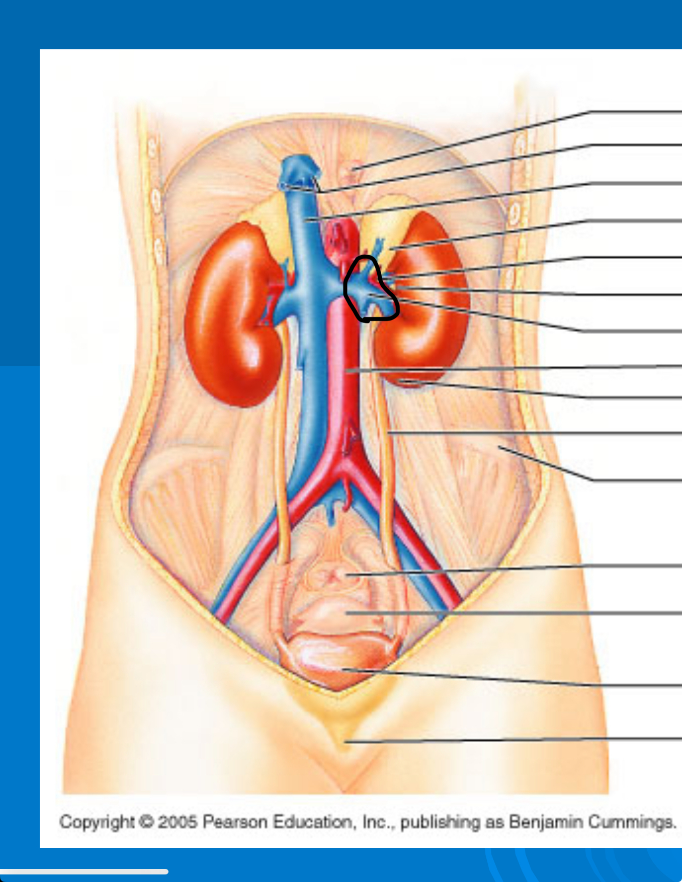 <p>Renal vein</p>