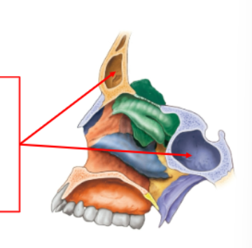 <p>paranasal sinuses (do or do not) lie in the same coronal plane?</p>