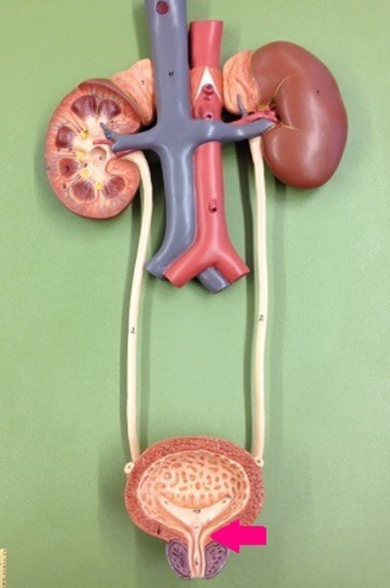 <p>Identify the sphincter.</p>