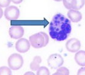 <p>What is this condition called?</p>