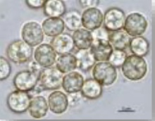 <p>What is this (1/4 classification of protozoans)</p>