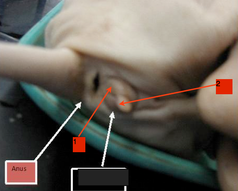 female pig: a small bud-like protrusion, just above the anus.