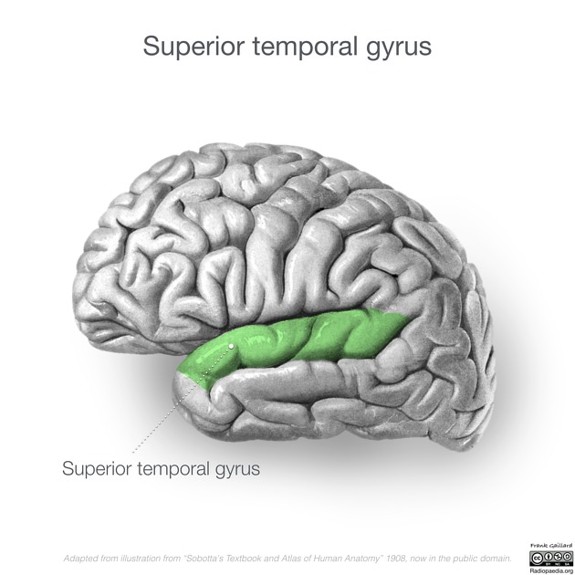 <p>superior temporal gyri </p>