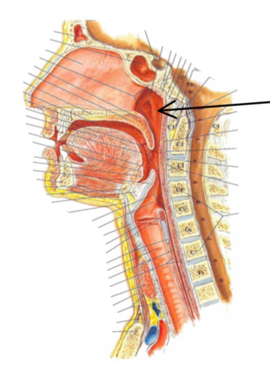 <p>Identify the structure indicated by the arrow</p>