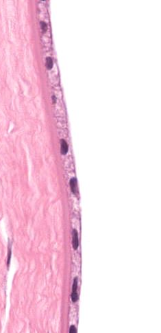 <p>simple squamous epithelium</p>