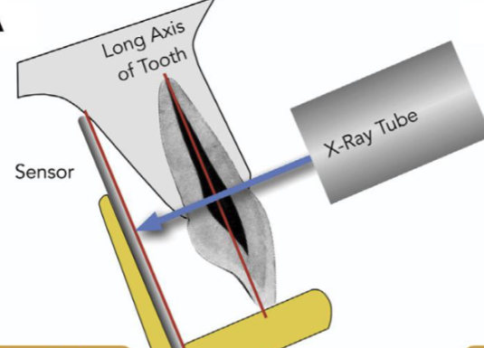 <p>ID the sensor technique</p>