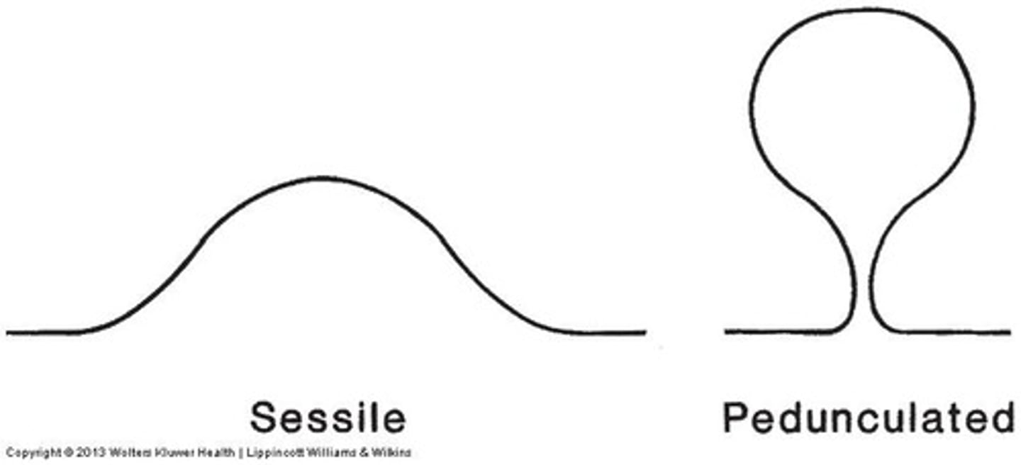 <p>such as a mole</p>