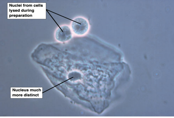 <p>Nuclei from cells lysed during preparation</p><p>Nucleus much more distinct</p>