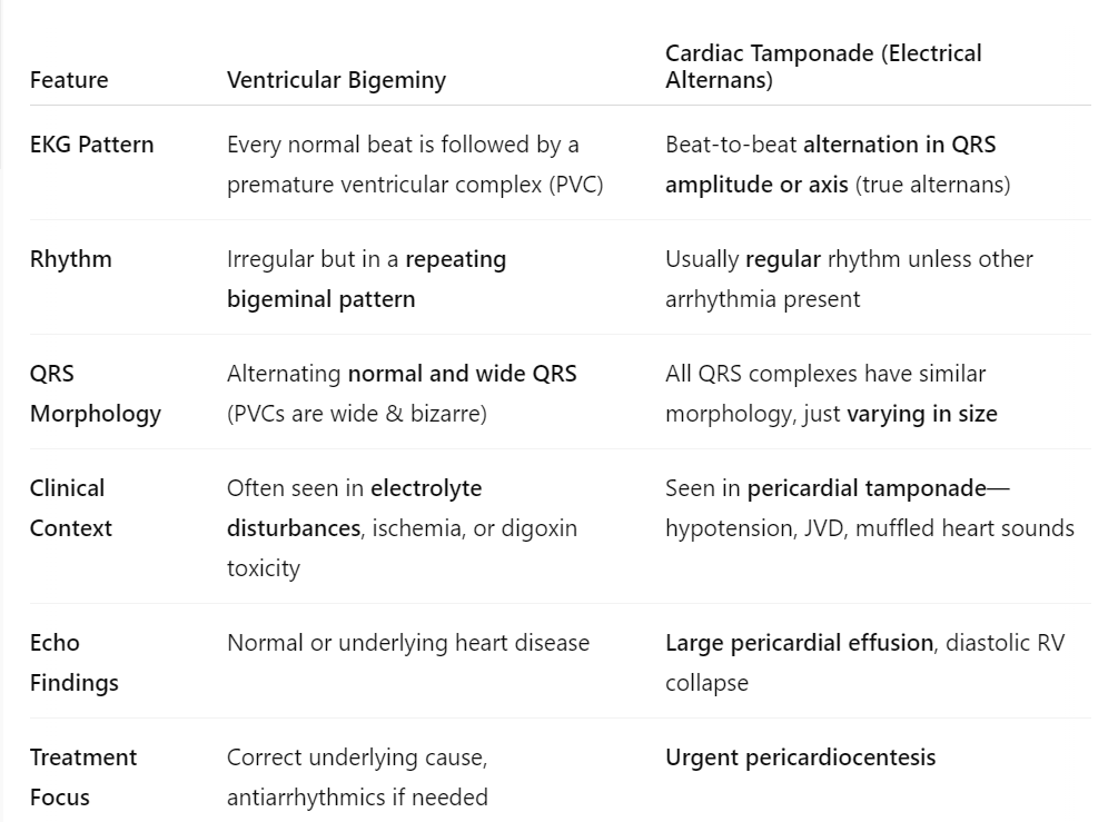 <p>c. pericardial tamponade<br><br>NOTE: don’t confuse it with ventricular bigeminy or PVCs, which can look similar to electrical alternans. see chart  </p>