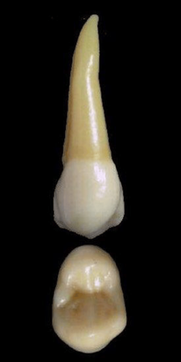 <p>what tooth is this &amp; why?</p>