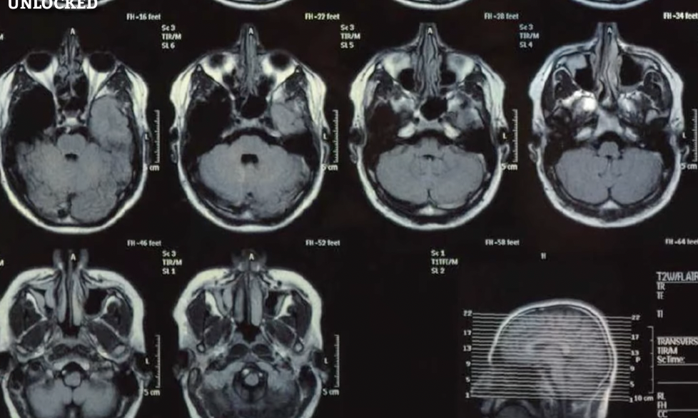 <p>Type of brain scan which reveals the <strong>structure</strong> of a person’s brain via x-ray technology.</p><p>CT scans look like horizontal “slices” of the brain at an angle above a person’s head.</p><p>Tomography stems from <strong>tomos, </strong>the greek word for <strong>cut</strong>. <strong>CT is a horizontal cut of the brain.</strong></p>