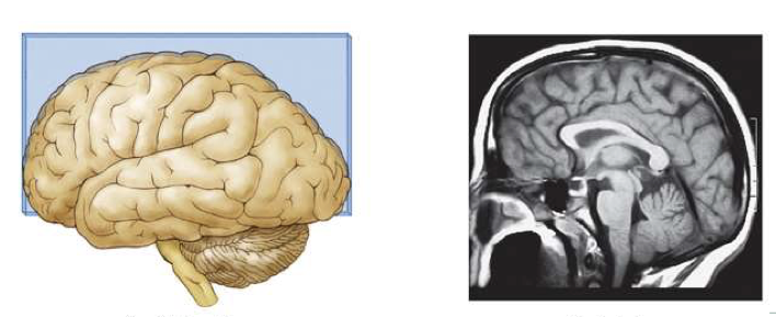 <p>What is this brain plane called? </p>
