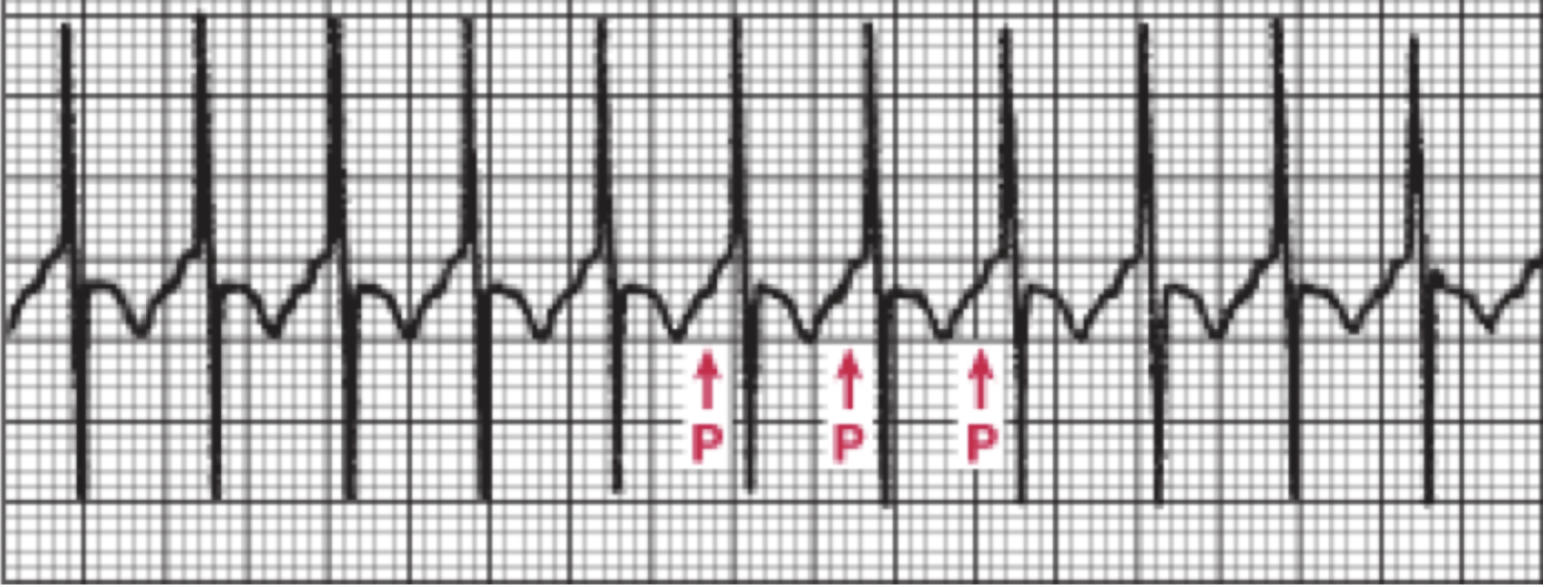 <p>What is this rhythm?</p>