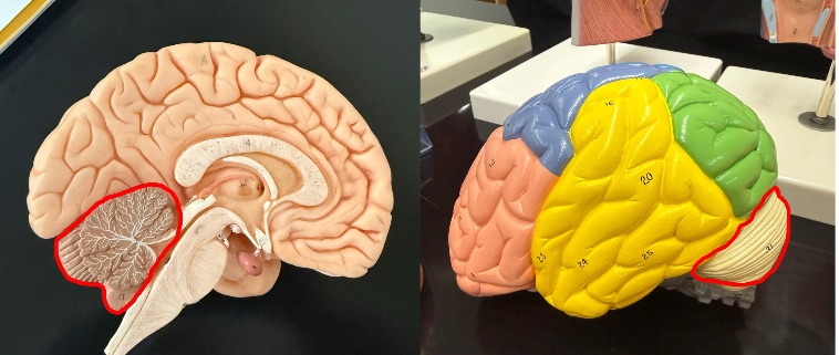 <p>What part of the brain is outlined in red?</p>
