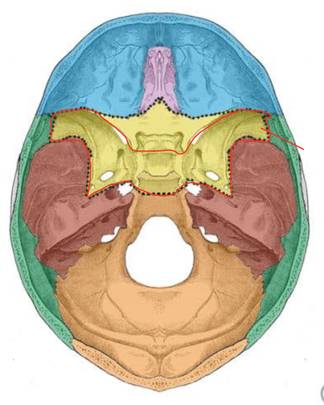 term image