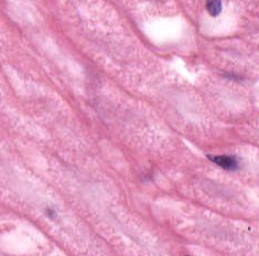 <p>light blue material at he center of each nerve fiber </p>