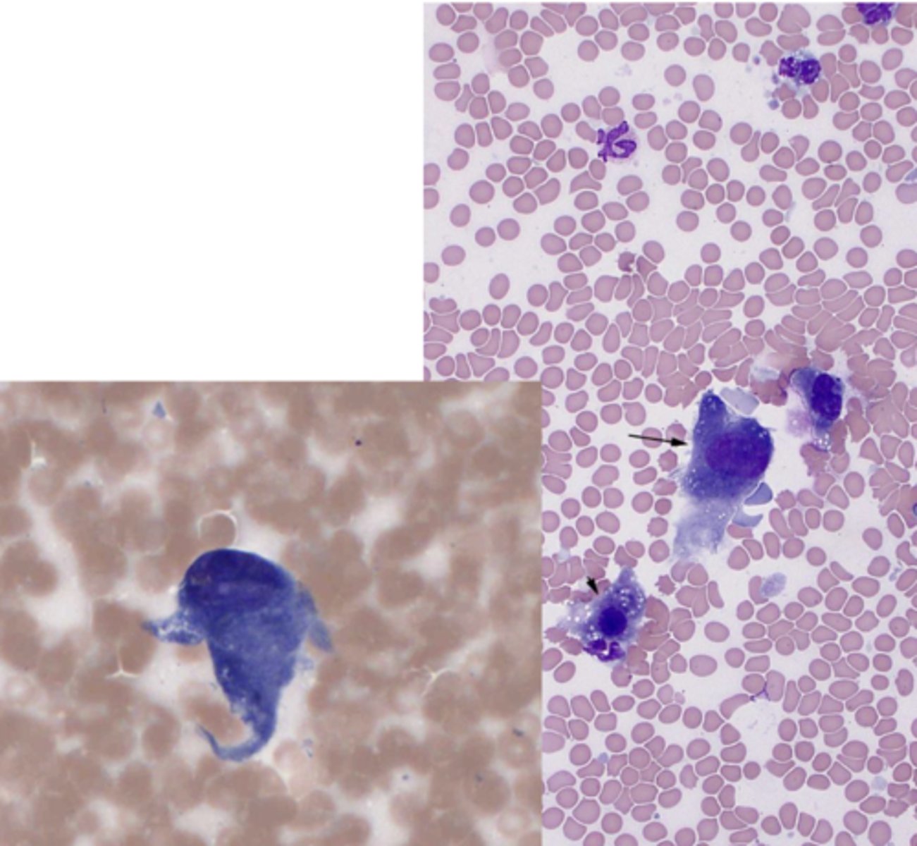 <p>What kind of neoplastic tumor is this?</p>